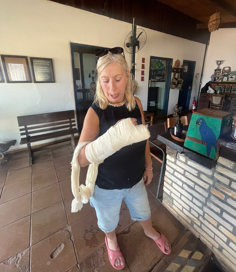 Sally con la mano y el brazo vendados después del hospital